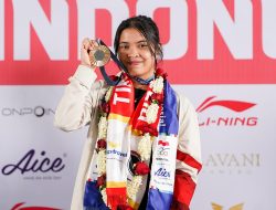 Gregoria Mariska Jalani Akupuntur dan Terapi Rutin Demi Pulih dari Vertigo